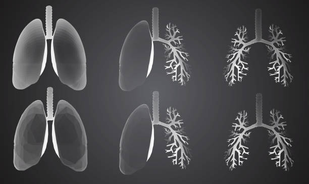 Vector set 3D lungs and bronchus. Isolated on white background. Element for medical design. vector art illustration