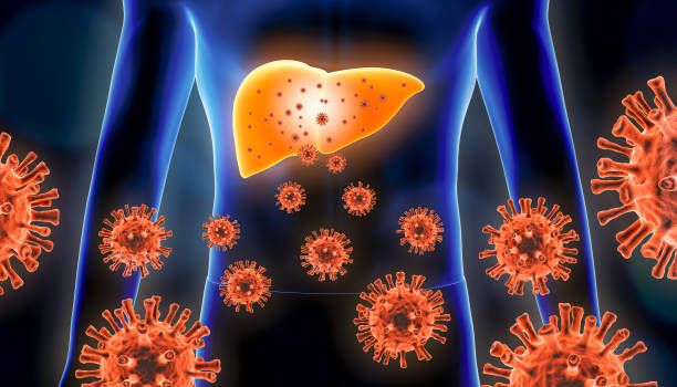 Hepatitis 3d rendering illustration with red virus cells and human body. Viral, infectious and inflammatory hepatic or liver disease, medical and healthcare concepts. stock photo