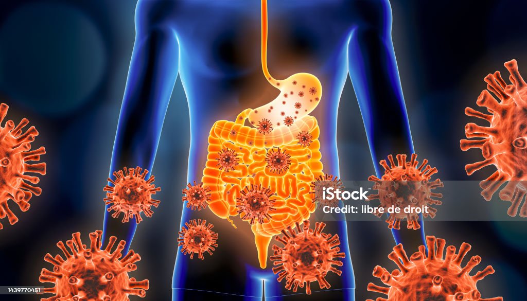 Gastroenteritis of stomach flu 3d rendering illustration with red virus cells and human body. Viral, infectious and inflammatory gastric or gastrointestinal tract disease, medical and healthcare concepts. Gastroenteritis Stock Photo