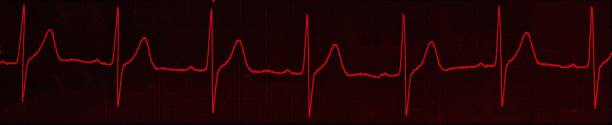 istock Red cardiogram isolated on a red background 1439774789