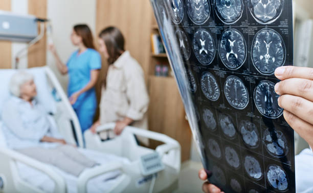 친척과 간호사와 함께 노인 환자 근처의 의료 병동에 서 있는 의사의 손에 있는 노인 여성의 머리의 mri. 뇌졸중 후 회복 - alzheimers disease 뉴스 사진 이미지