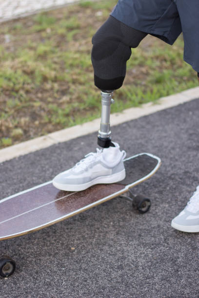istock Close-up of prosthetic leg on skateboard 1440031664