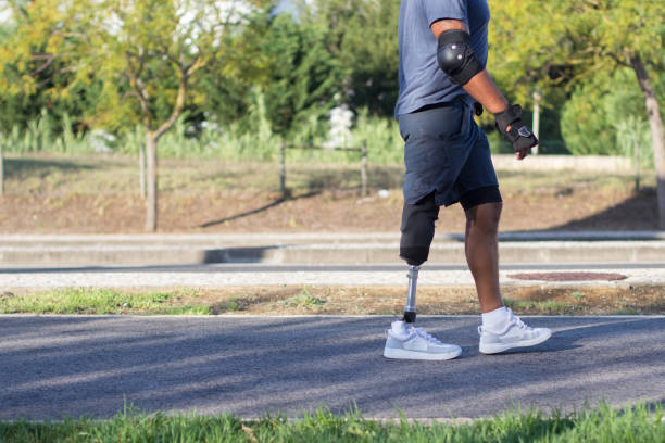 Person with disability walking in park. Man with mechanical leg strolling, trees in background. Nature, leisure, walking concept