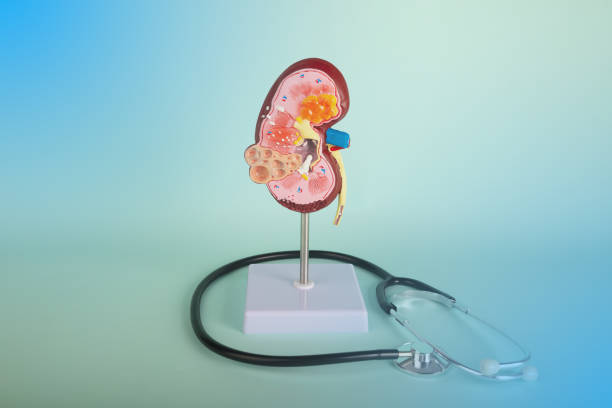 istock mockup kidney and stethoscope on a blue background 1440155617