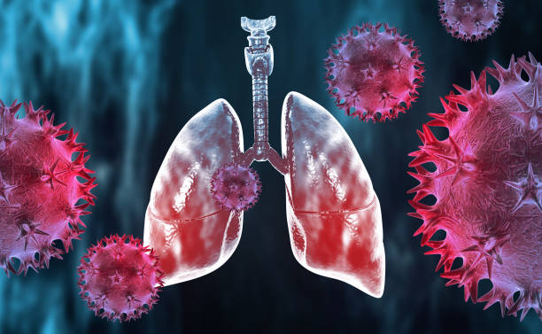 istock Virus attacking the human lungs. Lung disease. Viral infection. 3d illustration 1440170067