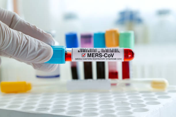 Technican testing blood sample with presence positive to MERS-CoV virus Doctor holding tube of blood sampleidentified with Positive to MERS-CoV or Camel virus in the laboratory. Technican testing blood sample with presence positive to MERS-CoV virus middle east respiratory syndrome stock pictures, royalty-free photos & images