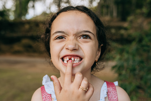 Little girl showing missing baby tooth