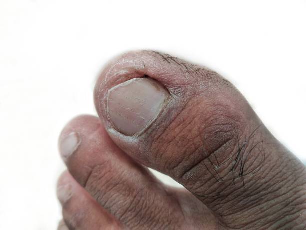 istock Close-up toe foot fingers isolated on white background 1440467295