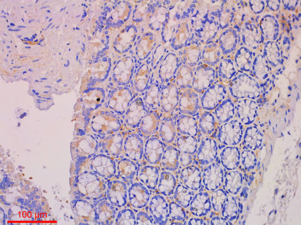 istock Immunohistochemistry Staining in Histopathology 1440562579