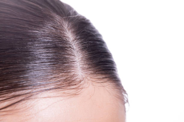 istock hair care 1440824380