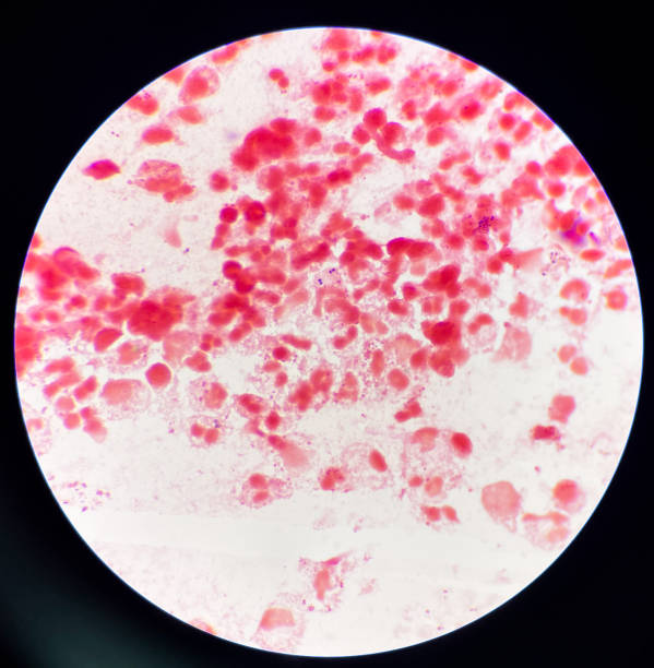 istock Red cell D-shape Gram-negative diplococci in vaginal smear. 1441076597