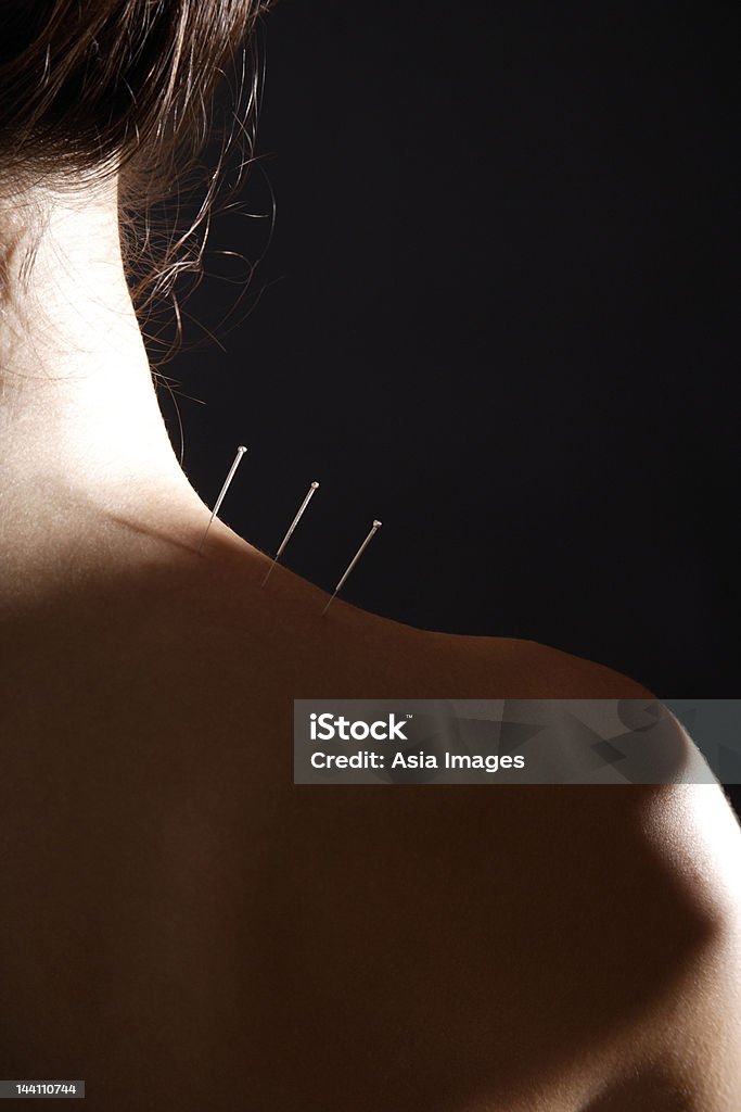 Akupunktura igły w kobieta's neck - Zbiór zdjęć royalty-free (25-29 lat)