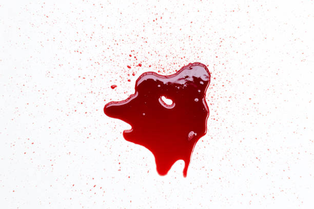 istock Drops of blood on white background. 1441560811