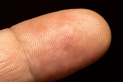 Primer plano de la piel de un dedo humano sobre un fondo negro photo