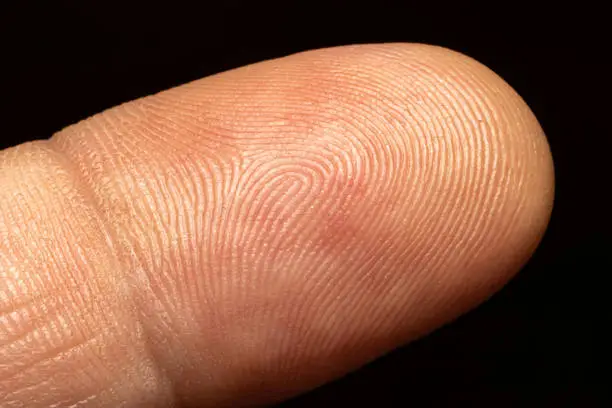 A closeup shot of a human finger skin on a black background