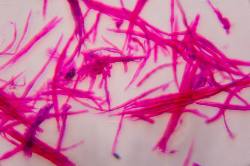 A smooth muscle separate under the microscope - Abstract pink lines on white background
