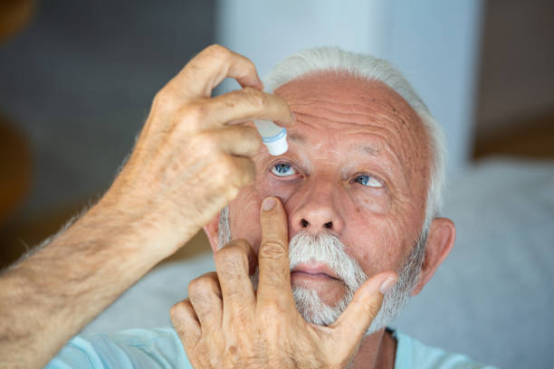 Man putting liquid drops in his eye solving vision problem.Senior dropping eye drop medicine healing his eye pain. Vision and ophthalmology medicine, Senior gray hair man applying eye drop. hombre poniéndose gotas líquidas en el ojo resolviendo problemas de visión. senior dejando caer la medicina de gotas para los ojos que cura su dolor ocular. medicina de la visión y oftalmología, hombre de cabello gris senior que se aplica gotas para l