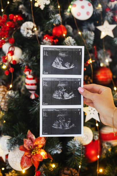 女性の手の接写で将来の赤ちゃんの超音波写真 - armenian ethnicity ストックフォトと画像