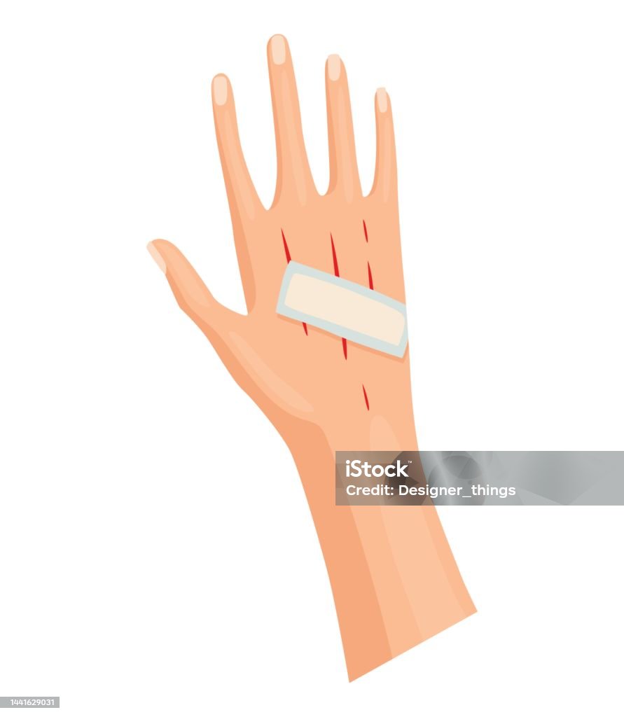 Hands Injured Skin Procedures Bandaging First Stock Vector, 50% OFF