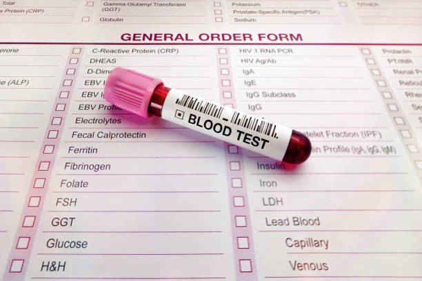 Blood test tube and form with list of analysis tests in medical laboratory stock photo