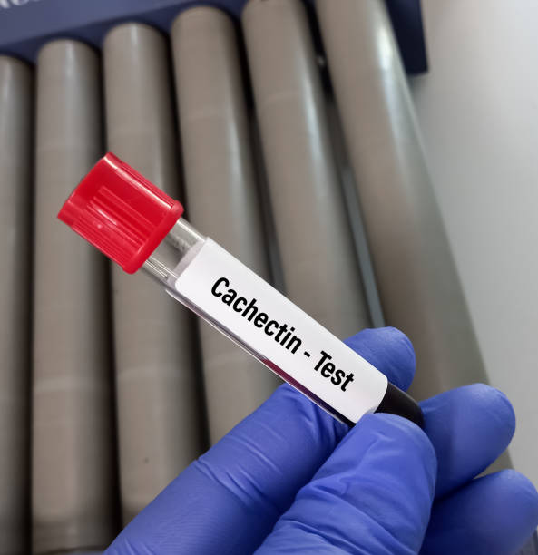 istock Blood sample for Cachectin test, an inflammatory cytokine produced by macrophages or monocytes during acute inflammation.TNF-α or Tumor necrosis factor alpha test. 1441767391