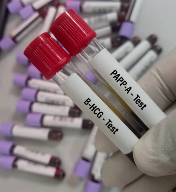 campione di sangue per papp-a e test b-hcg libero per la sindrome di down e trisomia 18. test di screening del primo trimestre. - 698 foto e immagini stock