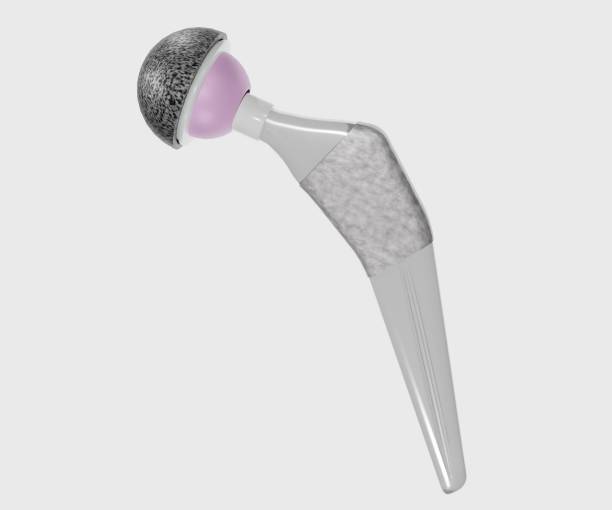 isolated Cochleate systems 3d rendering Total hip replacement components and examples of commercial hip stem implant 3D Rendering hip replacement stock pictures, royalty-free photos & images