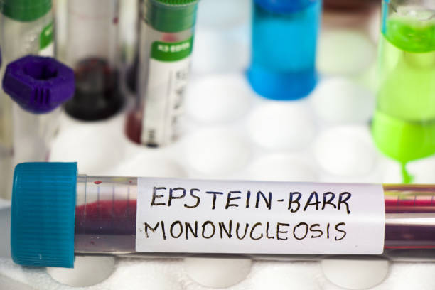 Closeup of an EPSTEIN-BARR virus test tube on the table in the laboratory A closeup of an EPSTEIN-BARR virus test tube on the table in the laboratory epstein barr virus photos stock pictures, royalty-free photos & images
