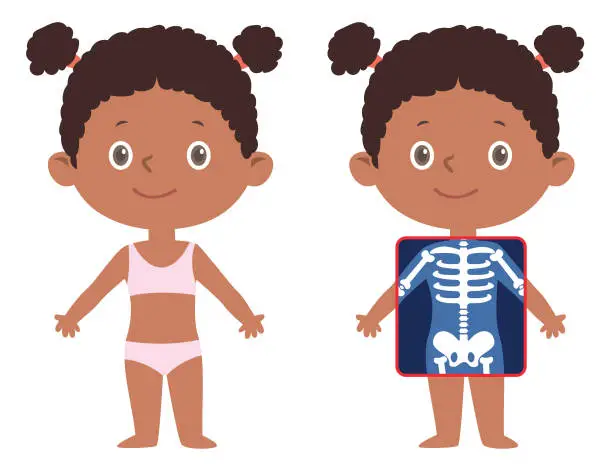 Vector illustration of African Little Girl internal skeleton x-ray