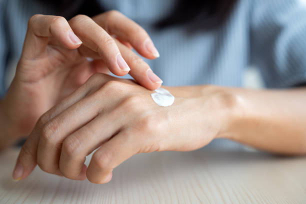 istock Woman applying moisturizer cream on dry hands 1442105252