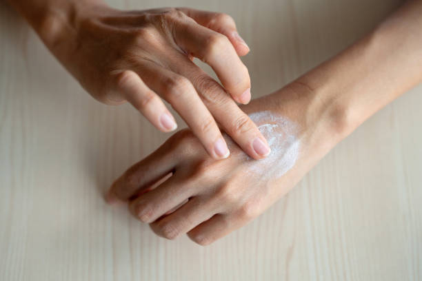 istock Woman applying moisturizer cream on dry hands 1442106638