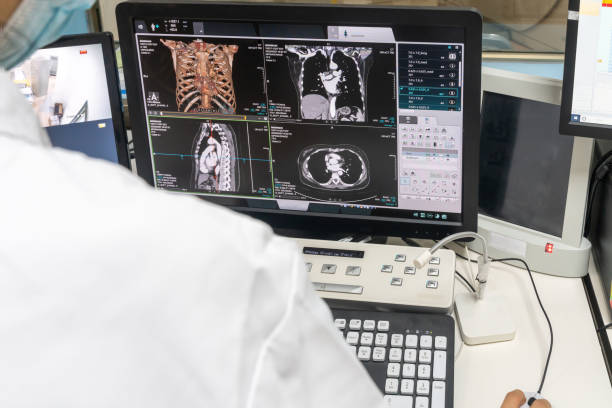 istock Doctor analyzing the test results from MRI Scanner on the computer during Covid 19 pandemic 1442123141