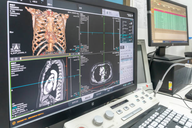 istock Doctor analyzing the test results from MRI Scanner on the computer during Covid 19 pandemic 1442123153