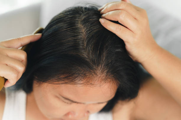 istock closeup Asian woman having problem with grey, white hair 1442134479