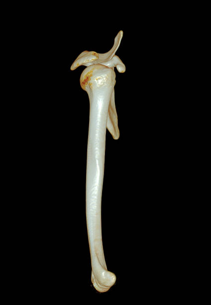 istock CT SCAN of arm 3D rendering isolated on black background . 1442166039