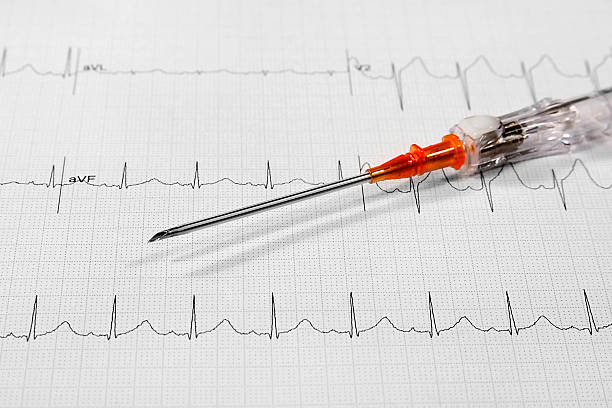 istock large bore IV catheter on 12 lead EKG 144218449
