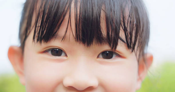 close up portrait asian girl child with black eye looking at camera
