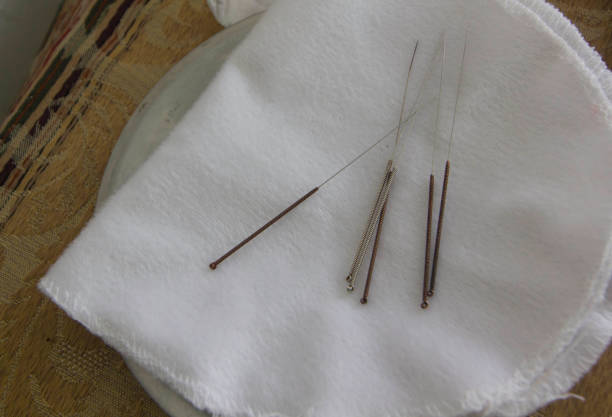 acupuntura stock photo