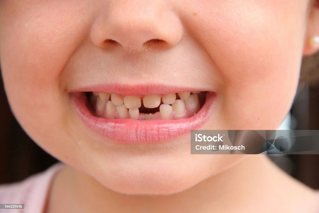 New tooth A child with a growing new tooth Child Stock Photo
