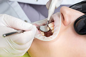 zahnarzt-untersucht-den-mund-des-patienten-mit-zahnspiegel-in-der-klinik.jpg?b=1&s=170x170&k=20&c=ovmb1_Tt5X9reaCXPZF4PwW2zuG8Jnbifw9xphC0tsc=