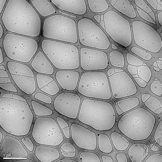 A shot with a cryogenic electron microscope, these are electron images, or micrographs; an anticancer drug (doxorubicin)