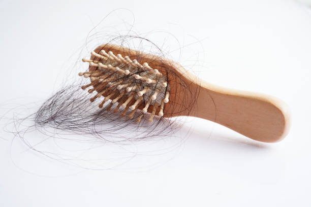 istock Hair loss fall with comb brush isolated on white background. 1442436230