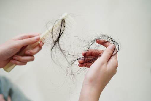 La mujer asiática tiene problemas con la pérdida de cabello largo en su mano. photo
