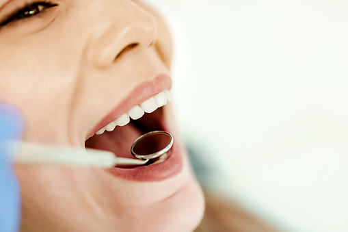 Close-up of open mouth during oral checkup at the dentist