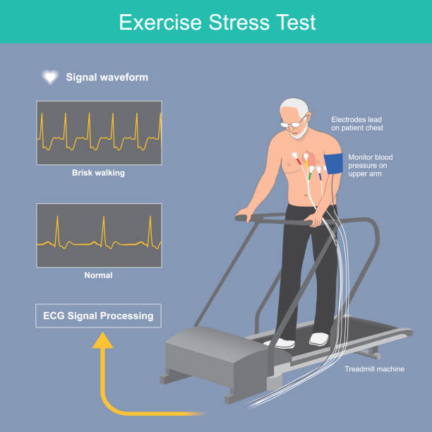 Exercise stress test. Older man the heart beat test on electric treadmill and results electric signal waveform display on monitor. Exercise stress test. Older man the heart beat test on electric treadmill and results electric signal waveform display on monitor. cardiac conduction system stock illustrations