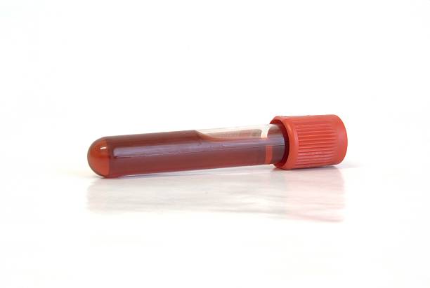 istock Test tube with blood 144281232