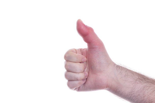 fragment of right hand with a swollen finger after a bee bite on white background, bigger due to allergy reaction after a wasp sting, red sensation on fingers and hands, finger wounded, skin irritation