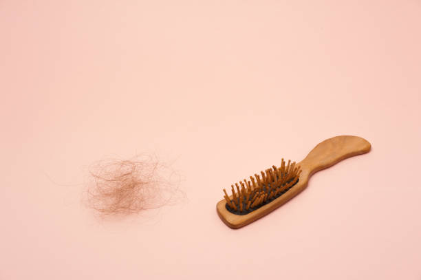 istock hair loss 1442952729