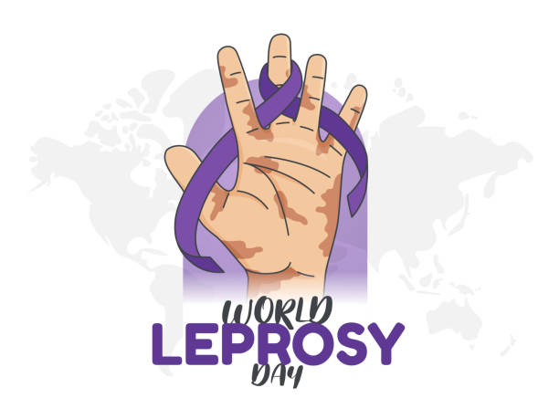 World Leprosy Day Vector Illustration Symbol. Healthcare Leprosy Design. Awareness Concept with Purple Ribbon World Leprosy Day Vector Illustration Symbol. Healthcare Leprosy Design. Awareness Concept with Purple Ribbon leprosy stock illustrations