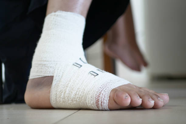 Twisted swollen adult ankle on a white sheet